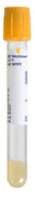 BD Vacutainer® Trace Element K2 EDTA (K2E) 5.4 mg Tube, 13x75 mm, 3.0 mL, Royal Blue Closure 100 each/pack, 10 pack/case 367777