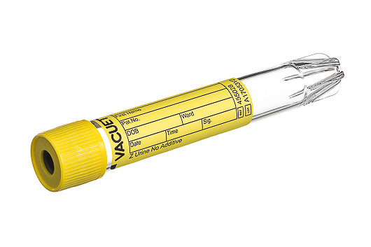 Tube Urine Vacuette 9ml 16x100 Ylw No Add Conical Base Pk/50 455028RK
